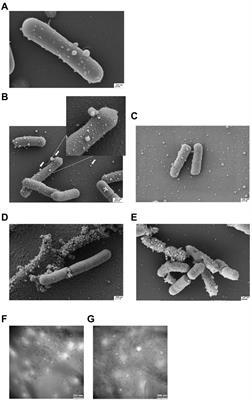 Extracellular membrane vesicles from Limosilactobacillus reuteri strengthen the intestinal epithelial integrity, modulate cytokine responses and antagonize activation of TRPV1